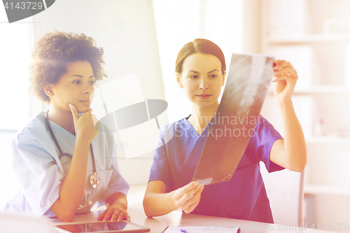 Image of female doctors with x-ray image at hospital