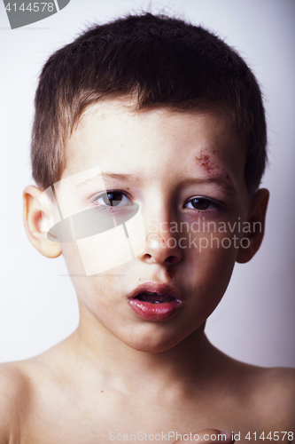 Image of Little boy whipped close up, isolated 