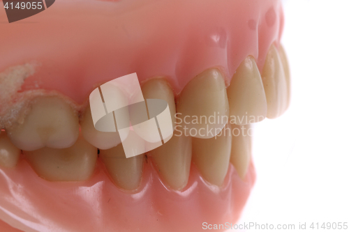 Image of teeth prothesis background