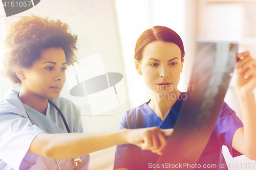 Image of female doctors with x-ray image at hospital