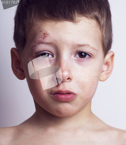 Image of Little boy whipped close up, isolated