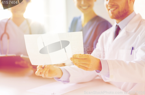 Image of close up of doctors with cardiogram at hospital 