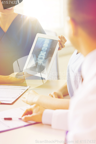 Image of close up of happy doctors with x-ray at hospital