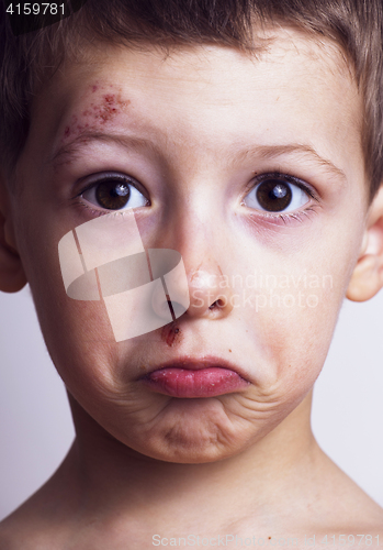 Image of Little boy whipped close up, isolated 