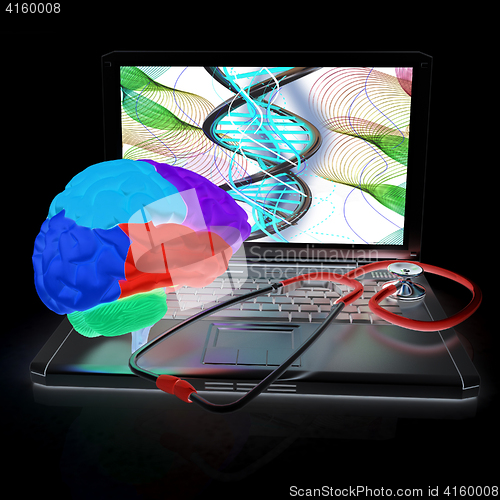 Image of Laptop, brain and Stethoscope. 3d illustration