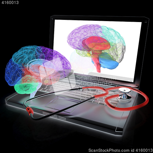 Image of Laptop, brain and Stethoscope. 3d illustration