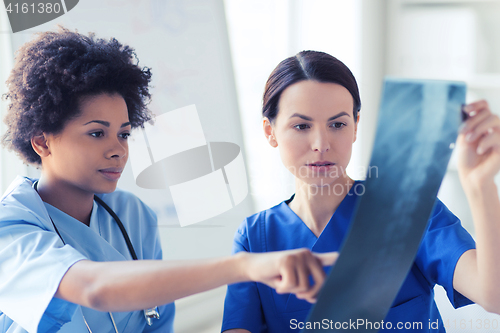 Image of female doctors with x-ray image at hospital