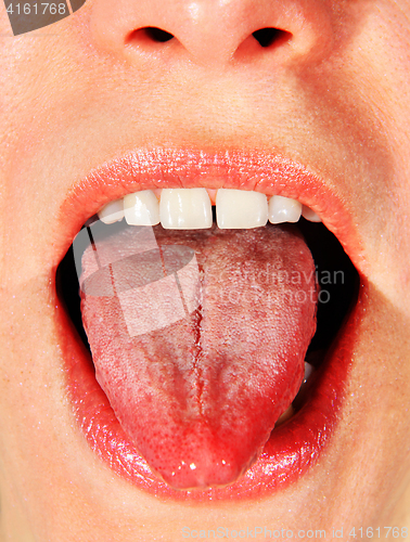 Image of opened mouth of woman