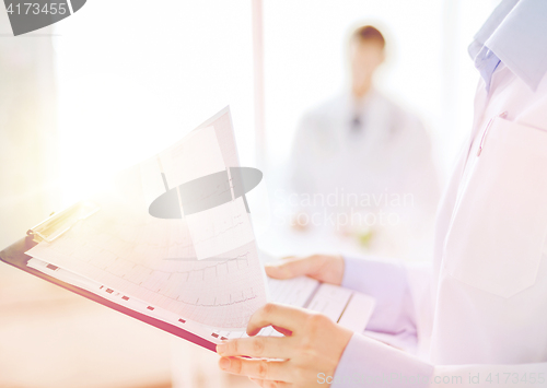 Image of female holding clipboard with cardiogram