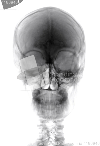 Image of Human Head Xray Cutout