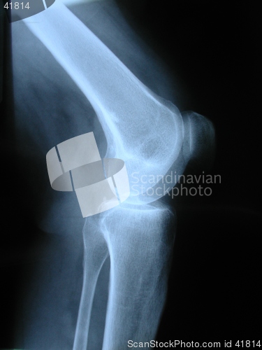Image of X-ray
