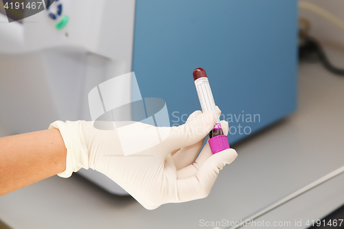 Image of Blood sample in flask