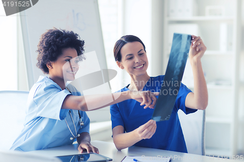 Image of happy female doctors with x-ray image at hospital