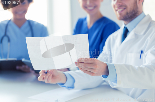 Image of close up of doctors with cardiogram at hospital 