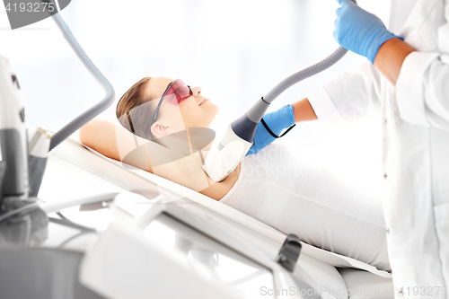 Image of Woman on laser hair removal