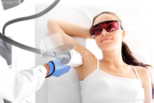 Image of Laser hair removal armpits Depilation armpits