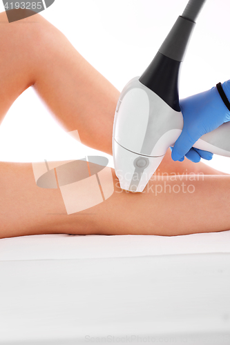 Image of Laser hair removal legs