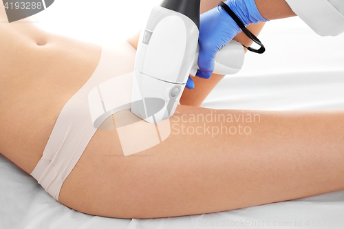 Image of Woman on laser hair removal treatments thighs and bikini area