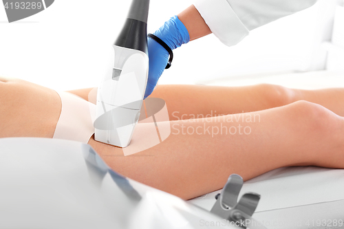 Image of Laser in aesthetic medicine. Epilation Woman on laser hair removal treatments thighs and bikini area