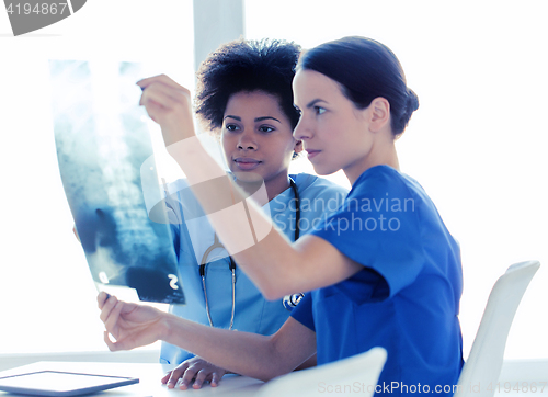 Image of doctors with x-ray image of spine at hospital