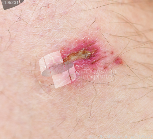 Image of wound on skin