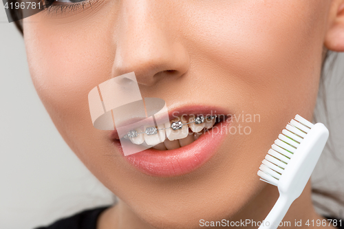 Image of Beautiful young woman with teeth braces