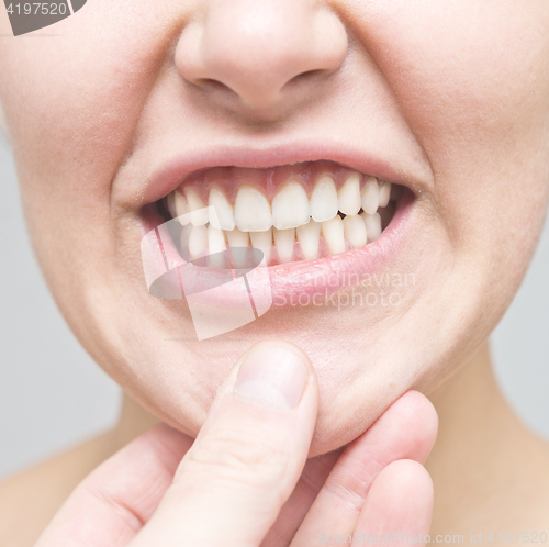 Image of checking the teeth