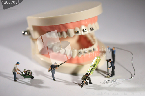 Image of Miniature Workers Performing Dental Procedures. Dental Office Ar