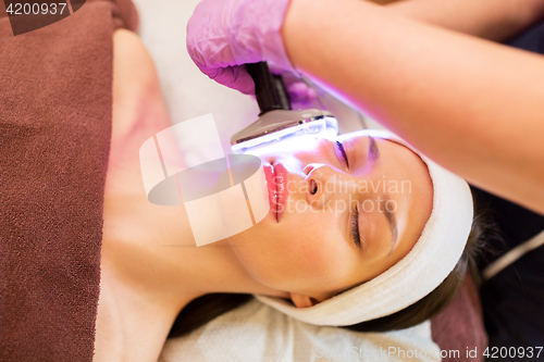 Image of young woman having face microdermabrasion at spa