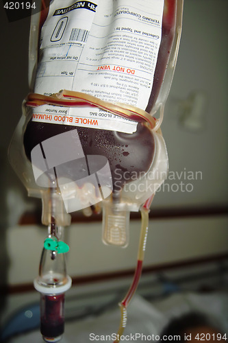 Image of Blood transfusion