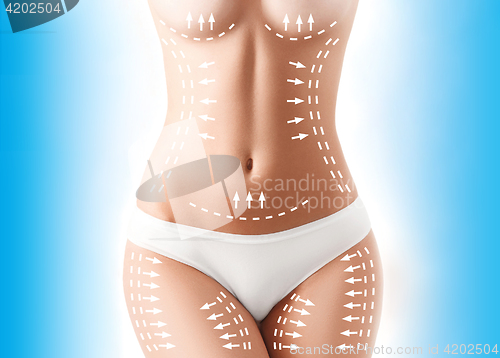Image of The cellulite removal plan. White markings on young woman body