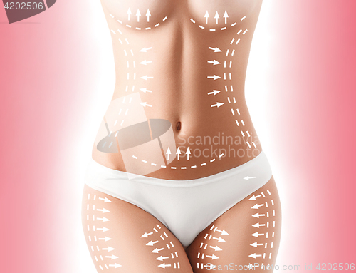Image of The cellulite removal plan. White markings on young woman body
