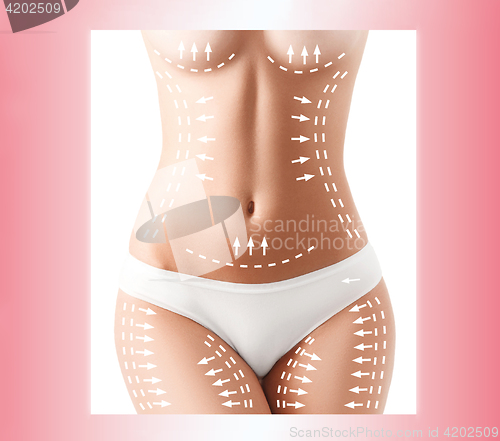 Image of The cellulite removal plan. White markings on young woman body