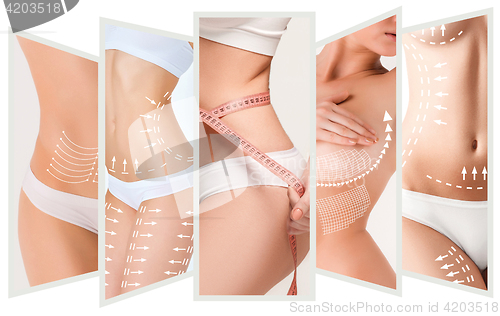 Image of The cellulite removal plan. White markings on young woman body