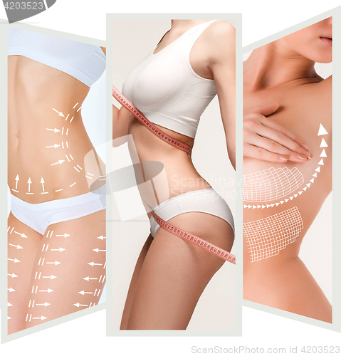 Image of The cellulite removal plan. White markings on young woman body