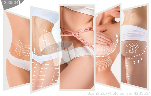 Image of The cellulite removal plan. White markings on young woman body