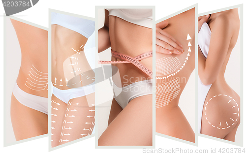 Image of The cellulite removal plan. White markings on young woman body