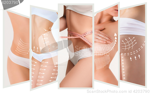 Image of The cellulite removal plan. White markings on young woman body