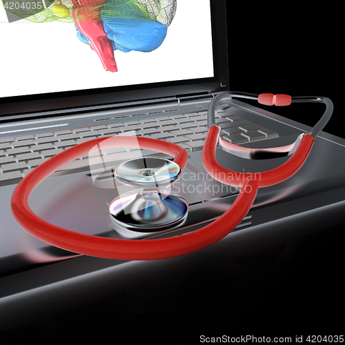 Image of Laptop, brain and Stethoscope. 3d illustration