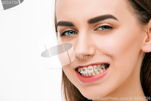 Image of Beautiful young woman with teeth braces