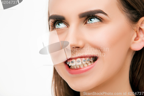 Image of Beautiful young woman with teeth braces