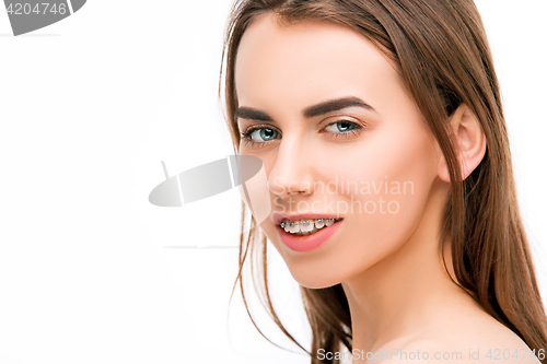 Image of Beautiful young woman with teeth braces