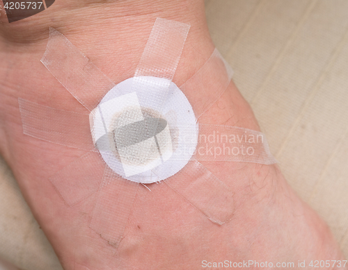 Image of plaster on foot