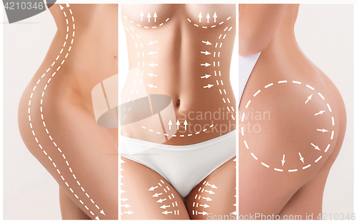 Image of The cellulite removal plan. White markings on young woman body