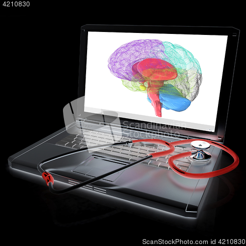 Image of Laptop, brain and Stethoscope. 3d illustration