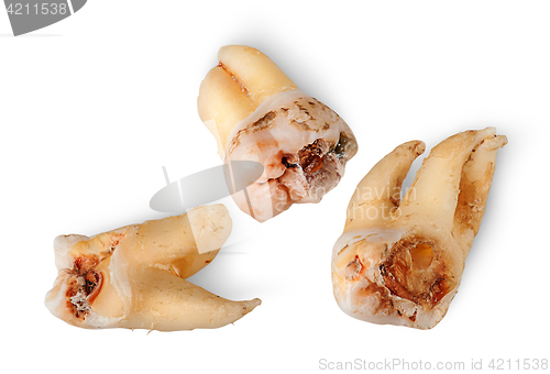Image of Closeup three teeth with caries