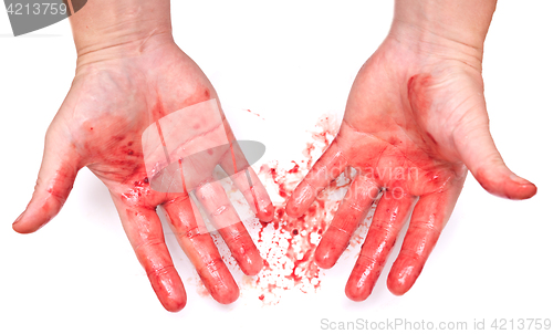 Image of bloody hands