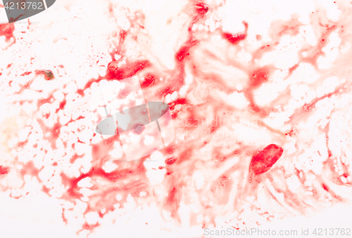 Image of blood on white