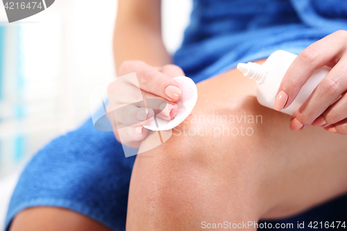 Image of Female disinfects the wound on his knee pouring with oxygenated water.