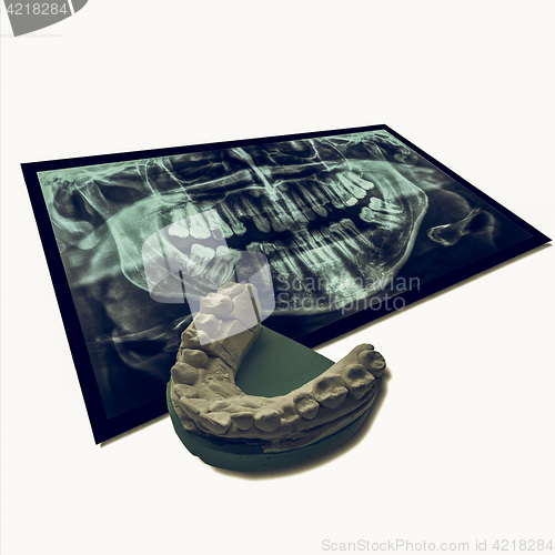 Image of Vintage looking Xray of teeth with positive teeth cast
